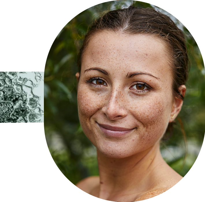 A young woman with youthful, freckled skin